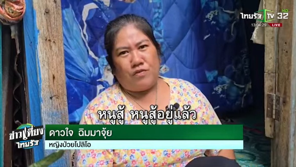 เห็นร่างกายแบบนี้ แต่ใจสู้มาก...เขาขอเพียงแค่มีเงินทุน เห็นแล้วน้ำตาซึมเลย 😥  คุณดาวใจสู้ๆนะคะ

คนในสังคมอย่างเราๆต้องช่วยเหลือกันนะ 🙏 ช่วยเขาเท่าที่เราจะทำได้ อย่ารอหน่วยงานภาครัฐฯค่ะ

ขอบคุณภาพจาก: ข่าวเที่ยงไทยรัฐ