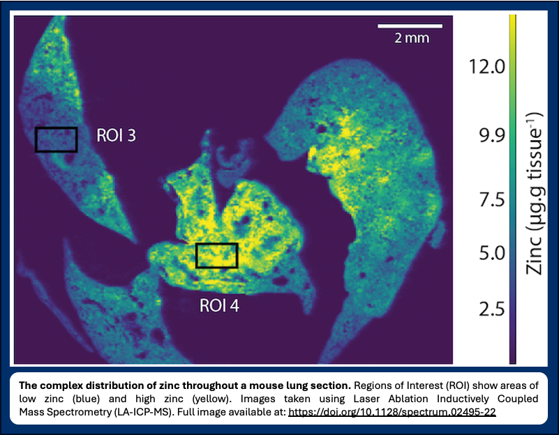 We're using laser ablation mass spectrometry to understand how trace metals are distributed by the immune system during infection.

This powerful analytical technique uses a laser beam to examine the elemental composition of solid samples. 

#WAAW #AMR