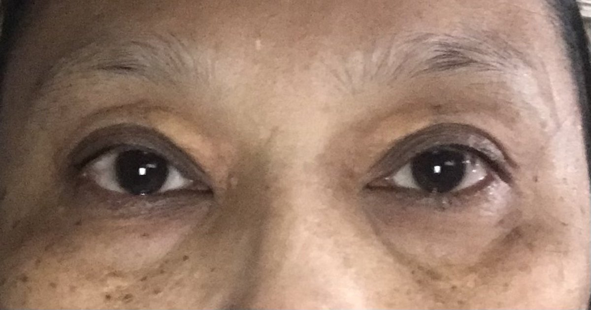 iaminamuhd's tweet photo. Is there a cure for my eyes😔 https://t.co/BQsOV10iUR