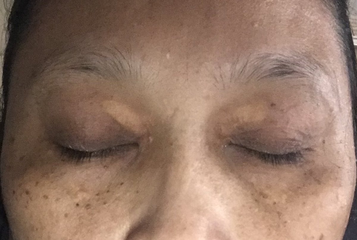 iaminamuhd's tweet photo. Is there a cure for my eyes😔 https://t.co/BQsOV10iUR