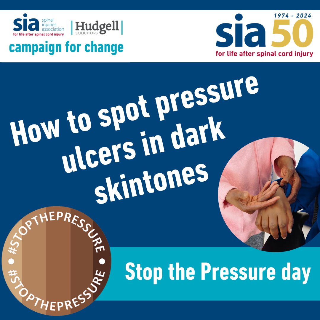 spinalinjuries's tweet image. 🔴Normally, pinkness or redness are an early indication of a pressure ulcer forming but with dark skin tones this often isn't the case. Find out more on our website⬇️
spinal.co.uk/news/stop-the-…
#STOPTHEPRESSURE #CheckEveryTone
In collaboration with @hudgellsol