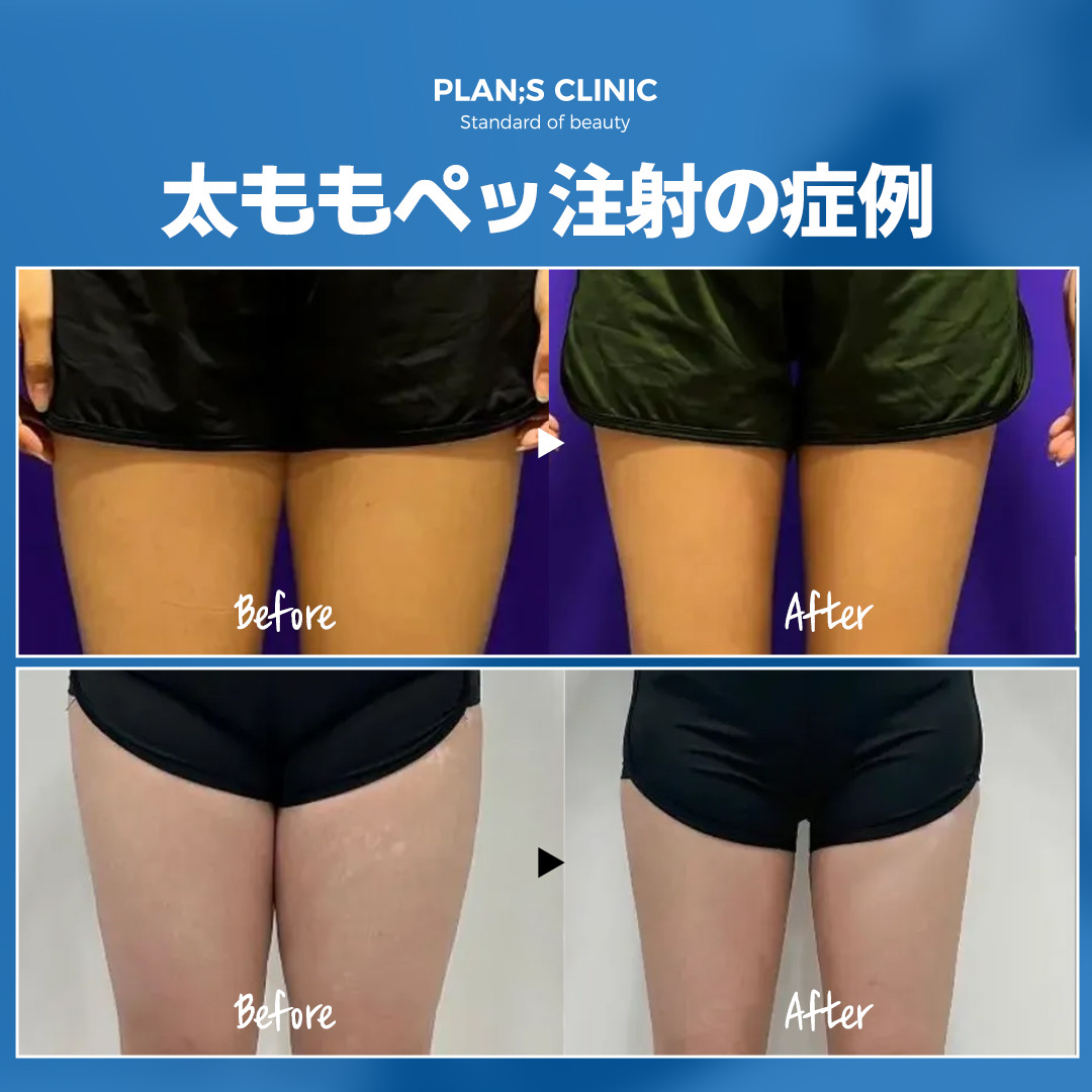 Избранное от 【公式】プランエスクリニック(PLAN;SCLINIC Избранное от 【公式】プランエスクリニック(PLAN;SCLINIC