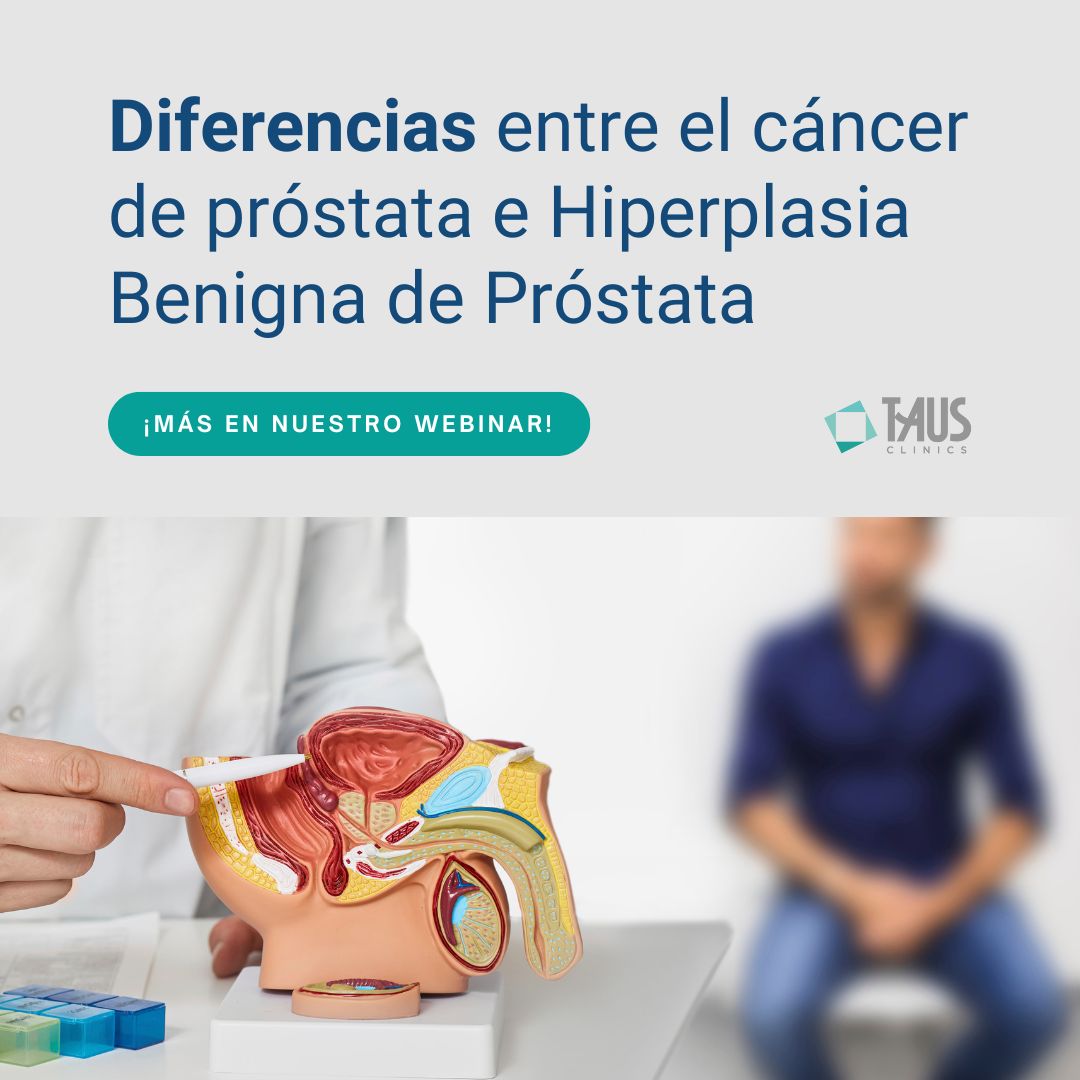 El cáncer de próstata es el más común entre los hombres en nuestro entorno, con 30.316 casos nuevos estimados en España en 2024, según SEOM. Detectarlo a tiempo mediante chequeos regulares es clave para un tratamiento exitoso y una mejor calidad de vida.