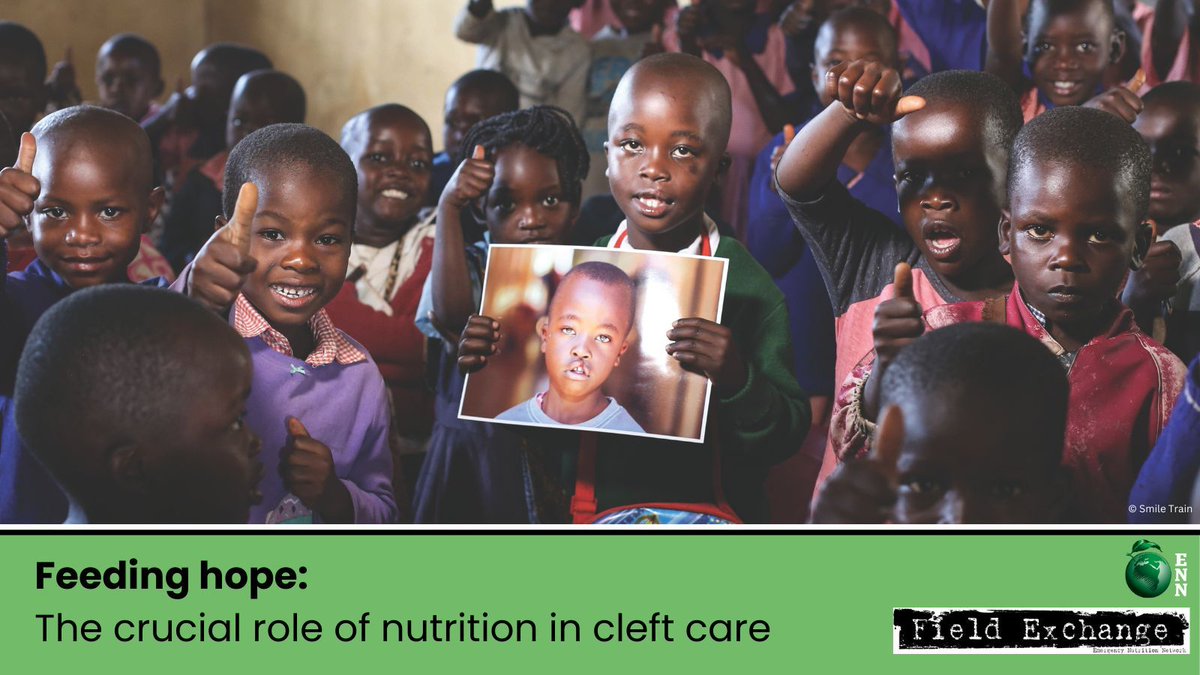 Emergency Nutrition Network (@ennonline) on Twitter photo Powerful stories from the DR of Congo, spotlighting the experiences of Apollo & Cikuru & their journeys to underscore critical gaps in the continuum of care for children with clefts regarding #nutrition.
Let's improve #CleftCare: buff.ly/40JWgJ0
#CleftCare #HealthEquity Powerful stories from the DR of Congo, spotlighting the experiences of Apollo & Cikuru & their journeys to underscore critical gaps in the continuum of care for children with clefts regarding #nutrition.
Let's improve #CleftCare: buff.ly/40JWgJ0
#CleftCare #HealthEquity