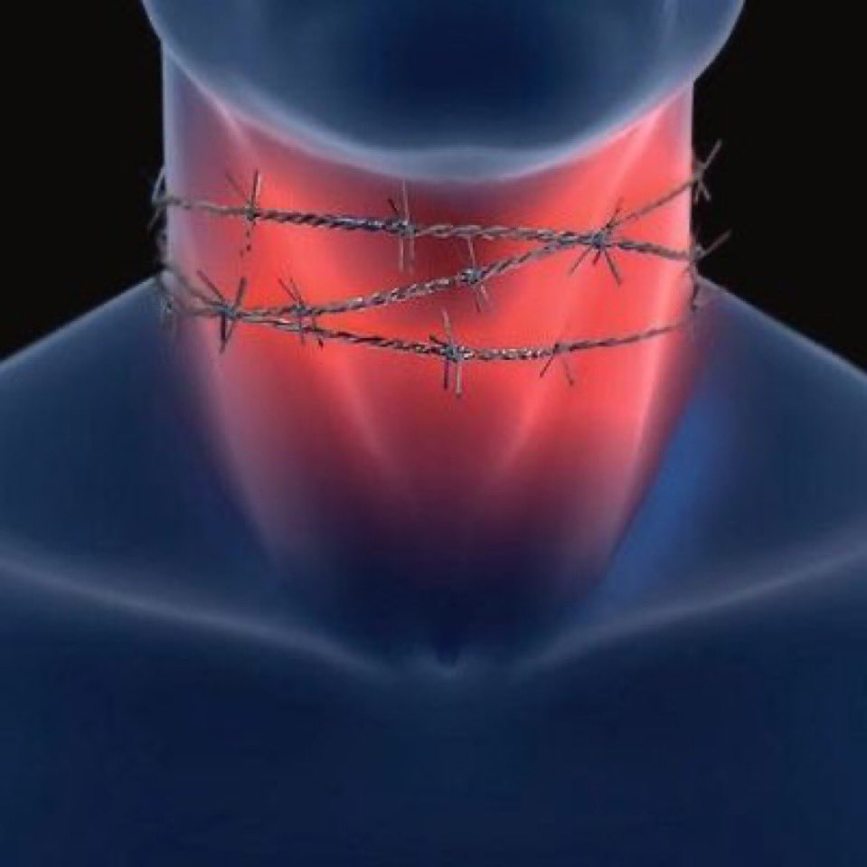 context_pdr's tweet image. Meslek hayatınızda böyle olduğunuz olaylar neler?