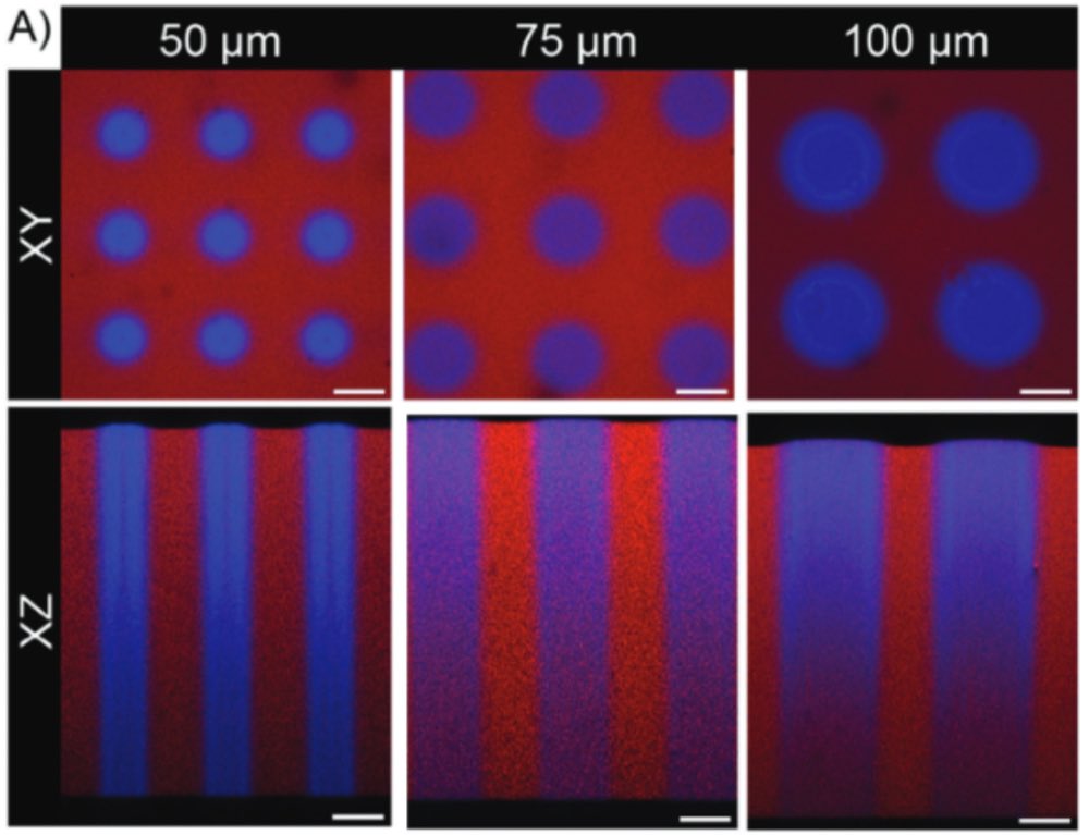 AnsethGroup's tweet image. 🎊 Thrilled to share our latest work in Advanced Functional Materials @AdvPortfolio, led by fantastic PhD student Mark Young. Mark used allyl-sulfide mediated spatial softening of hydrogel substrates to control differentiation in intestinal monolayers: onlinelibrary.wiley.com/doi/full/10.10…
