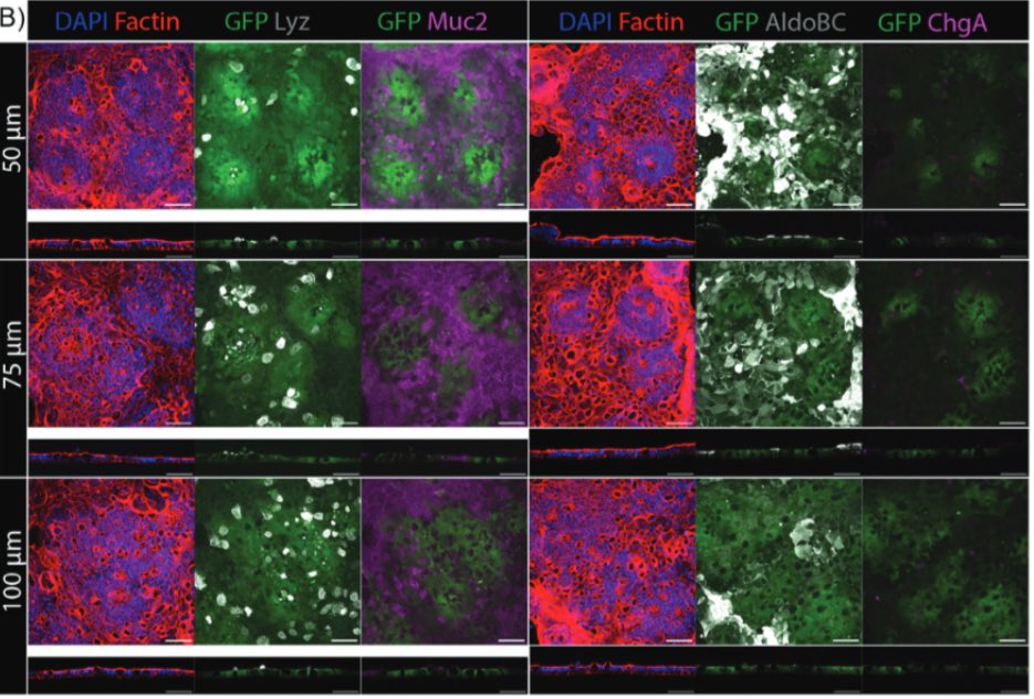 Anseth Group (@ansethgroup) on Twitter photo 🎊 Thrilled to share our latest work in Advanced Functional Materials <a href="/AdvPortfolio/">Advanced Portfolio News</a>, led by fantastic PhD student Mark Young. Mark used allyl-sulfide mediated spatial softening of hydrogel substrates to control differentiation in intestinal monolayers: onlinelibrary.wiley.com/doi/full/10.10… 🎊 Thrilled to share our latest work in Advanced Functional Materials <a href="/AdvPortfolio/">Advanced Portfolio News</a>, led by fantastic PhD student Mark Young. Mark used allyl-sulfide mediated spatial softening of hydrogel substrates to control differentiation in intestinal monolayers: onlinelibrary.wiley.com/doi/full/10.10…
