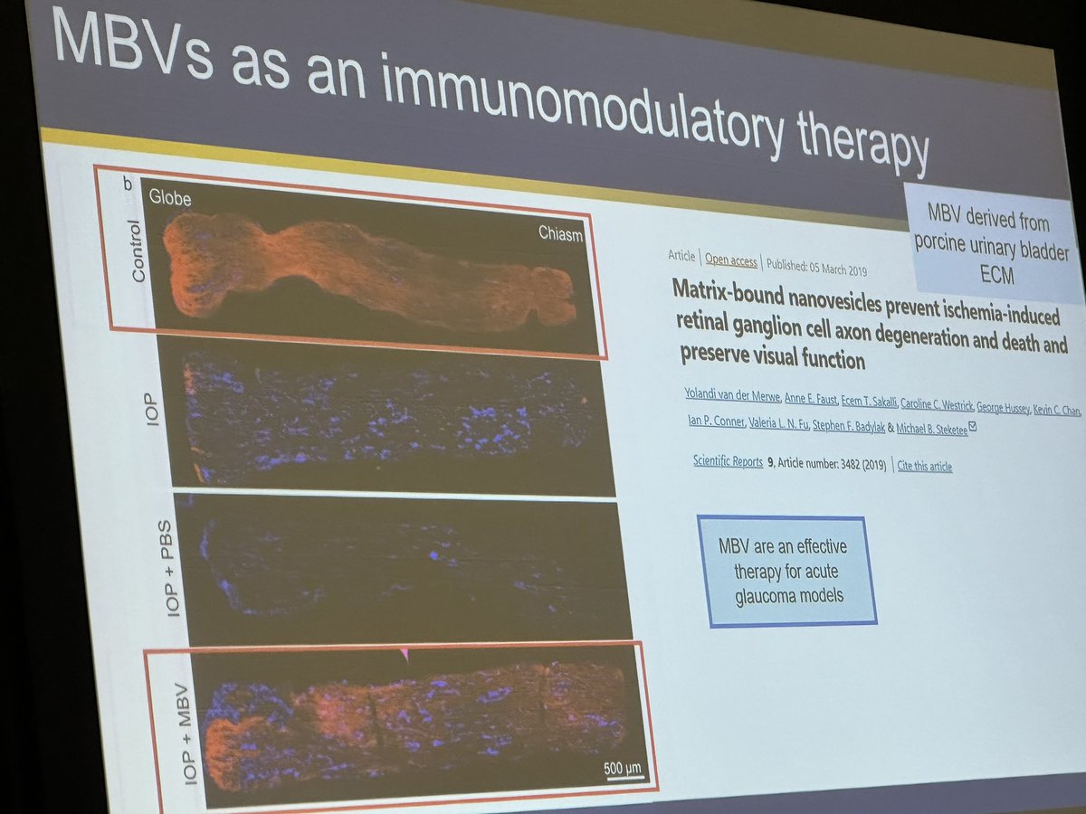 Most people who work on #ExtracellularVesicles from multicellular organisms and cell culture are studying the ones that float around freely. @DrMarleyDewey is not most people! She works on #EVs that bind to the #ECM extracellular matrix. These “matrix-binding vesicles” #MBVs are