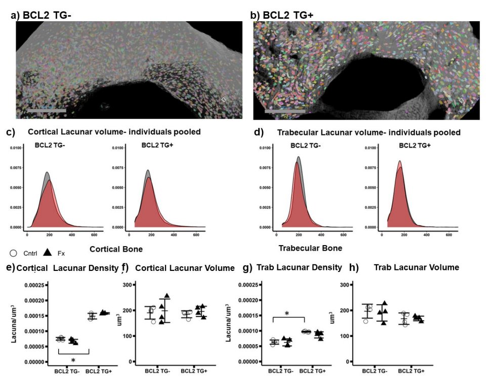 JBMRPlus (@jbmrplus) on Twitter photo Findings in this #JBMRPlus article suggest that osteocytes potentially play a significant role in the post-traumatic systemic response to fracture, though the effects differ between trabecular and cortical bone <a href="/benosipov1/">Benjamin Osipov</a> <a href="/OrrScience/">Sophie Orr</a>
Read more here: ow.ly/5FT550U5vw8 Findings in this #JBMRPlus article suggest that osteocytes potentially play a significant role in the post-traumatic systemic response to fracture, though the effects differ between trabecular and cortical bone <a href="/benosipov1/">Benjamin Osipov</a> <a href="/OrrScience/">Sophie Orr</a>
Read more here: ow.ly/5FT550U5vw8