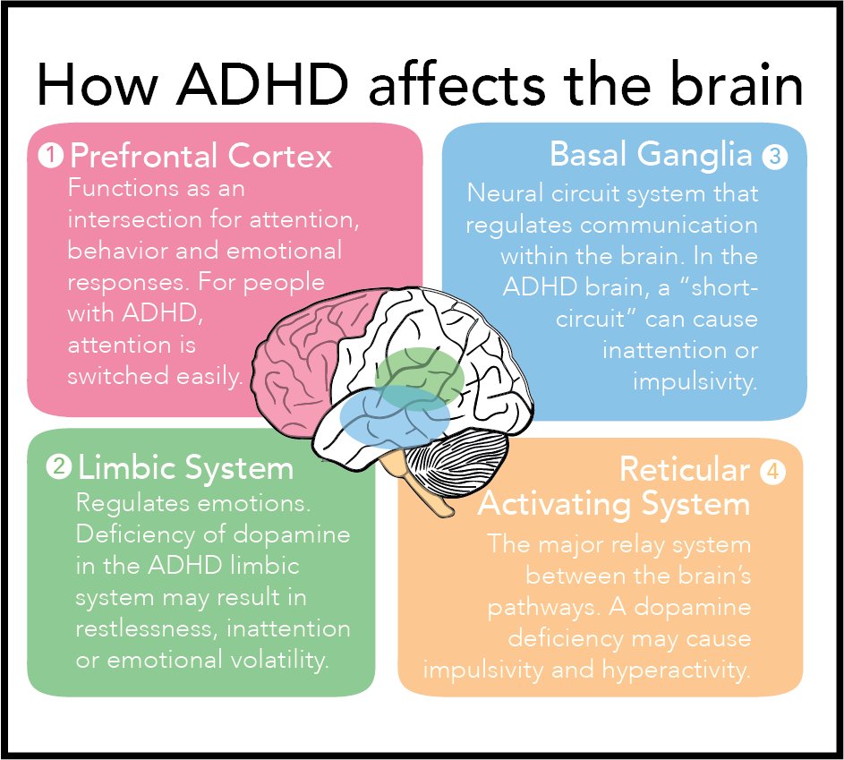 HussainIbarra's tweet photo. Researchers realized that people with ADHD have different brains, nerve networks, and neurotransmitters than "normal" people.

When you have ADHD, some of your neural networks aren't as effective—it's hard for it to switch off "daydreaming mode"

But this isn't a bad thing… https://t.co/NheCUeJtI7
