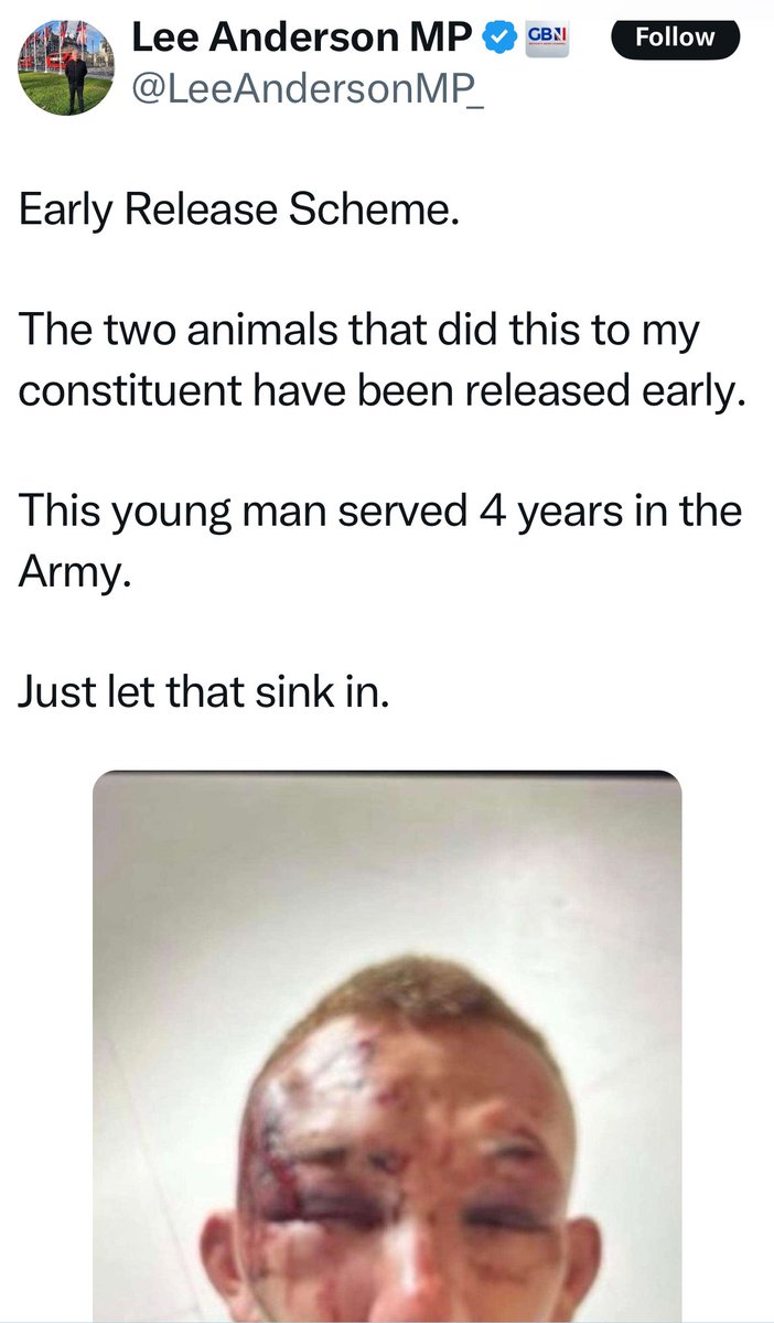 mryorkshiretea's tweet image. Lee Anderson posted this a few weeks ago but it actually was an attack by 2 brothers in Selston and they were released under the Tories years ago when Anderson was still a member of the Tory party. He said nothing at the time. Just let that sink in #RachelFromAccounts