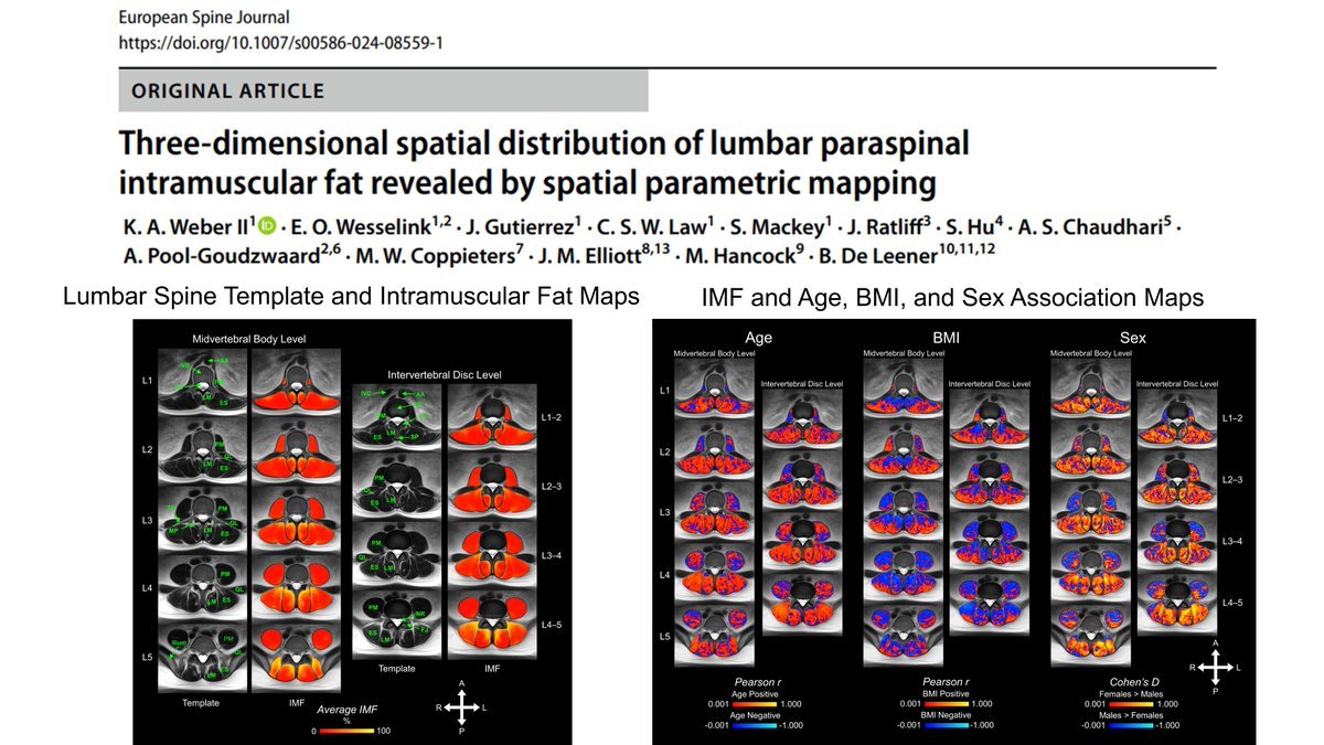 Dr. Sean Mackey (@drseanmackey) on Twitter photo Innovative research maps lumbar muscle health in 3D led by <a href="/DrKenWeber/">Ken Weber, DC, PhD</a> bit.ly/3YYQeSj
🧠 Why it matters: Intramuscular fat (IMF) in lumbar paraspinal muscles plays a critical role in low back pain (LBP). This study unveils the first 3D spatial distribution of IMF, Innovative research maps lumbar muscle health in 3D led by <a href="/DrKenWeber/">Ken Weber, DC, PhD</a> bit.ly/3YYQeSj
🧠 Why it matters: Intramuscular fat (IMF) in lumbar paraspinal muscles plays a critical role in low back pain (LBP). This study unveils the first 3D spatial distribution of IMF,