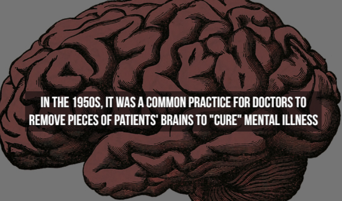 TCWTMedia's tweet image. 💡😱 Terrifying Thursday Fact! 😱💡
In the 1950s, a shocking practice to cure mental illness involved taking pieces of patients' brains! 😨 
 #TerrifyingThursday #MedicalHistory