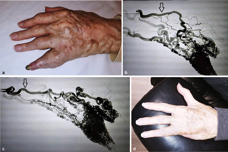 Seminars in Interventional Radiology tweet media