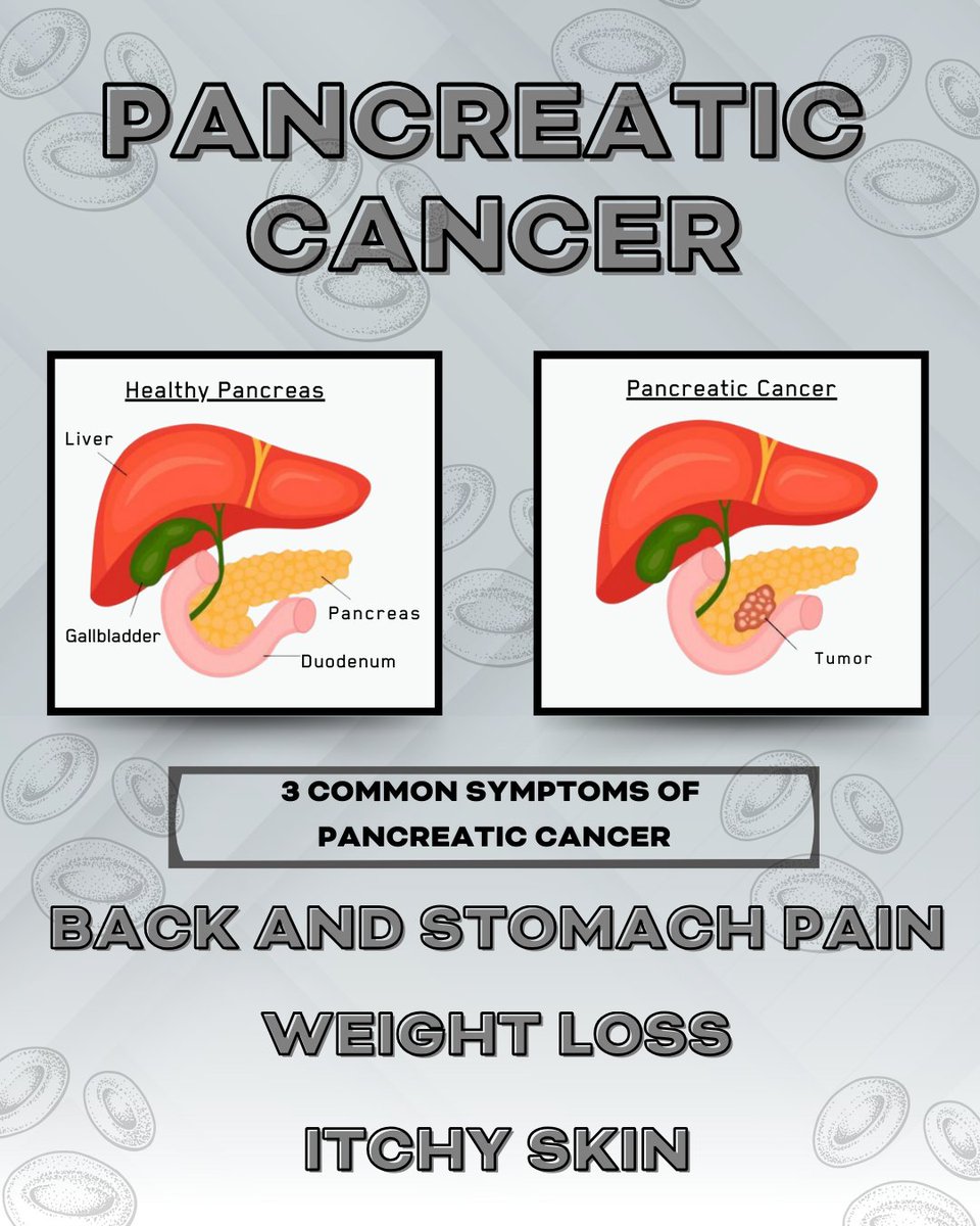 Pancreatic cancer is hard to detect early, but signs like weight loss, jaundice, or stomach pain shouldn’t be ignored. Early detection saves lives. 💜🔬 #PancreaticCancerAwareness