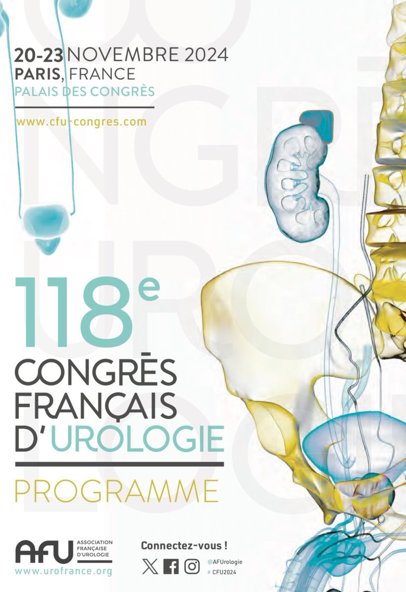 Julien Branchereau,MD,PhD (@branchereauju) on Twitter photo It was a great pleasure to welcome Prof. Darius from <a href="/ClinUnivStLuc/">Cliniques universitaires Saint-Luc</a> , who delivered an outstanding talk on oxygenated kidney perfusion.
Kudos to all the speakers of this great session #CFU2024 <a href="/AFUrologie/">Association Française d'Urologie - AFU</a>
<a href="/Prudhomme_thom/">Prudhomme Thomas</a> <a href="/UrologieParis/">Marc-Olivier Timsit, MD, PhD 🎗️</a> <a href="/sarah_drouin/">sarah drouin</a> Dr Culty It was a great pleasure to welcome Prof. Darius from <a href="/ClinUnivStLuc/">Cliniques universitaires Saint-Luc</a> , who delivered an outstanding talk on oxygenated kidney perfusion.
Kudos to all the speakers of this great session #CFU2024 <a href="/AFUrologie/">Association Française d'Urologie - AFU</a>
<a href="/Prudhomme_thom/">Prudhomme Thomas</a> <a href="/UrologieParis/">Marc-Olivier Timsit, MD, PhD 🎗️</a> <a href="/sarah_drouin/">sarah drouin</a> Dr Culty