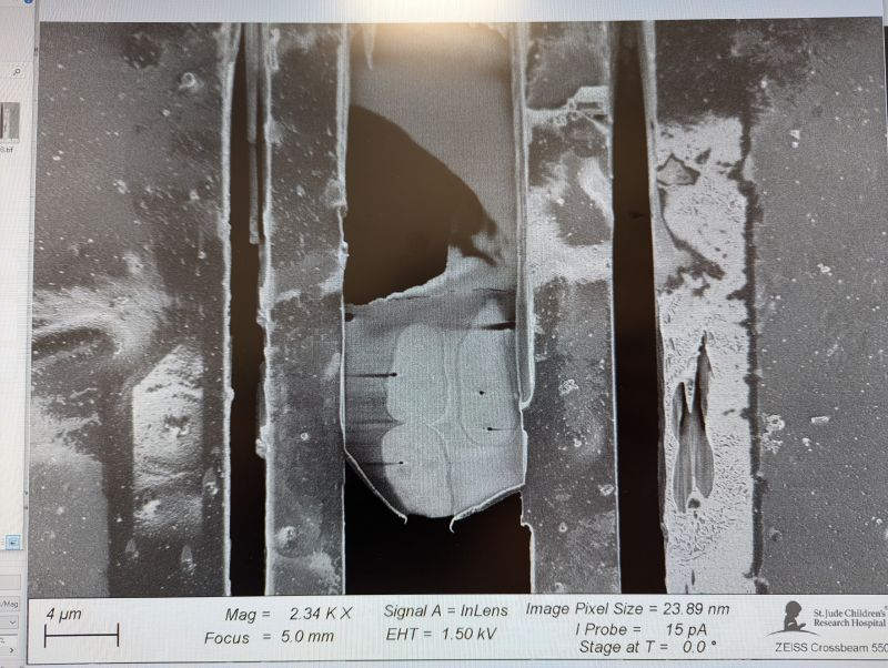 LabHalic's tweet image. Thrilled to share our first lamellae made here at St. Jude! Great work by Martin, Silvija and Robert!