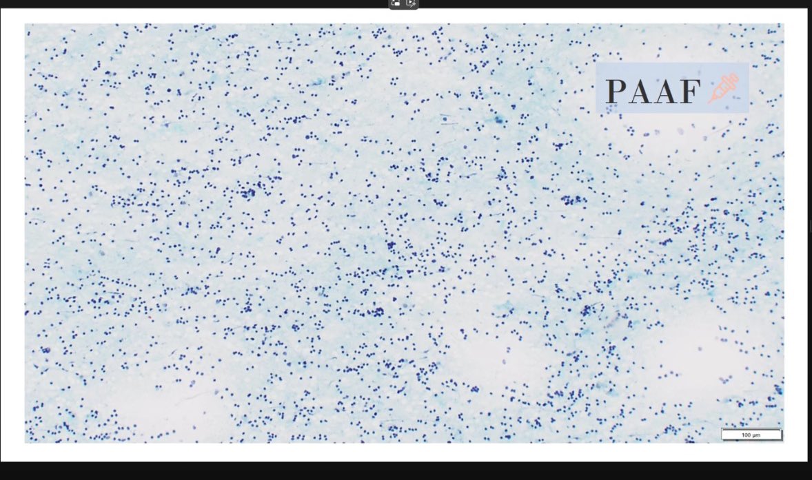 Bellvitge Pathology tweet media