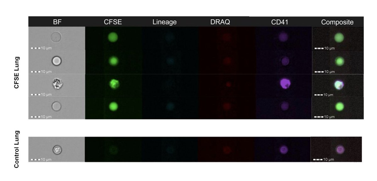 Journal of Clinical Investigation (@jclinicalinvest) on Twitter photo The origin of lung megakaryocytes and their contribution to the platelet pool has been debated for years.
@Alison_livada <a href="/CraigMorrell5/">Craig Morrell</a> & team used several tracing methods in mice and thrombocytopenia models, determining origin, Mk lifespan, and platelet pool contribution: The origin of lung megakaryocytes and their contribution to the platelet pool has been debated for years.
@Alison_livada <a href="/CraigMorrell5/">Craig Morrell</a> & team used several tracing methods in mice and thrombocytopenia models, determining origin, Mk lifespan, and platelet pool contribution: