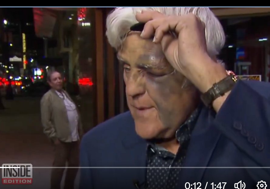 Tried wearing eyeshadow today and someone asked what happened to me