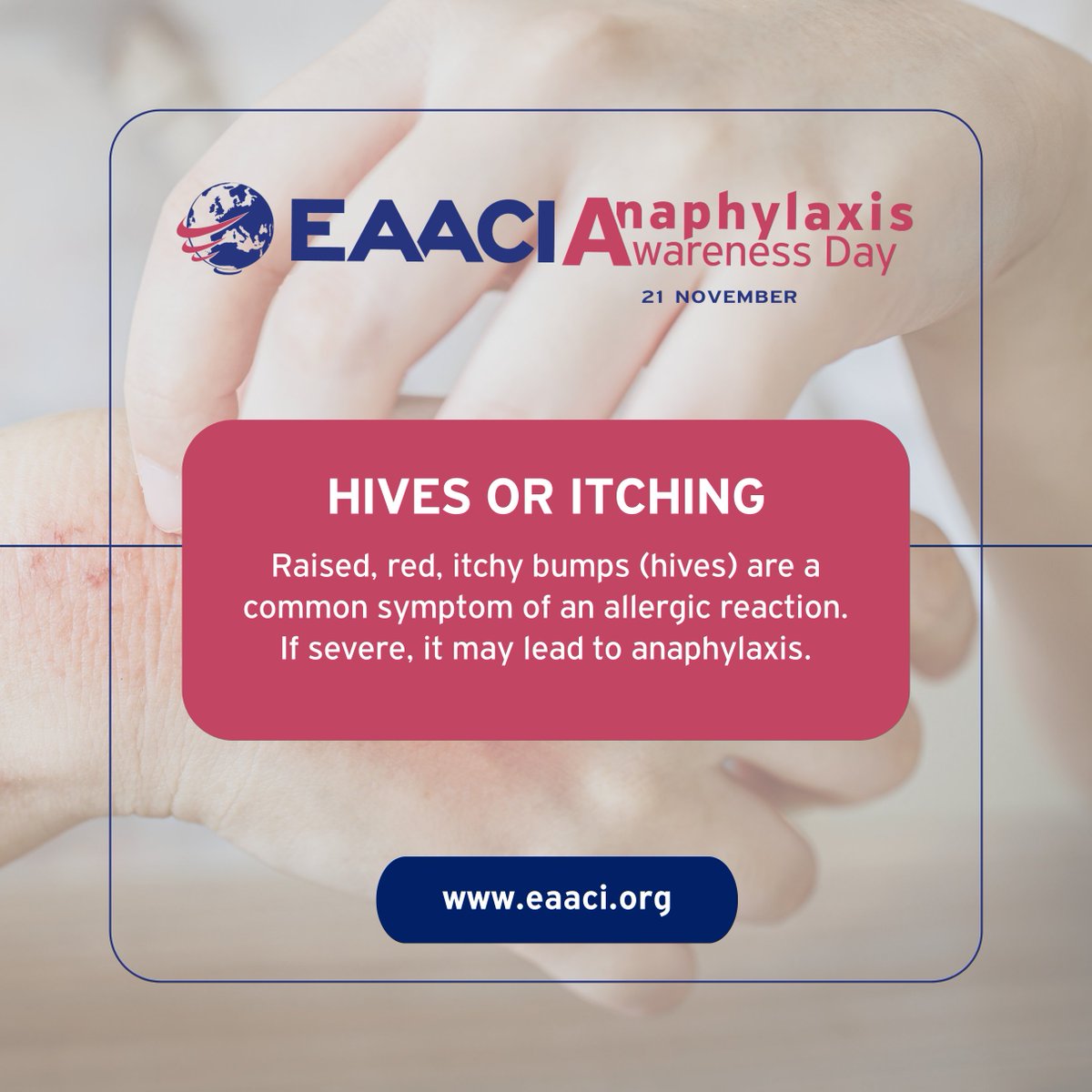 allergyact's tweet photo. Today is #WorldAnaphylaxisDay,
a day dedicated to raising awareness about anaphylaxis, a severe allergic reaction.

#AnaphylaxisAwareness #AllergySafety #EAACI #KnowTheSigns @eaaci https://t.co/bUNwcky24H