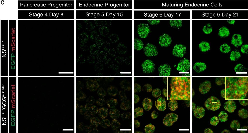 Diabetes, a research journal of the ADA 🧪 (@diabetes_ada) on Twitter photo Tracking insulin- and glucagon-expressing cells in vitro and in vivo using a double reporter human embryonic stem cell line.
Read Here diabetesjournals.org/diabetes/looku…
<a href="/ADA_Pubs/">ADA Professional Publications</a> Tracking insulin- and glucagon-expressing cells in vitro and in vivo using a double reporter human embryonic stem cell line.
Read Here diabetesjournals.org/diabetes/looku…
<a href="/ADA_Pubs/">ADA Professional Publications</a>