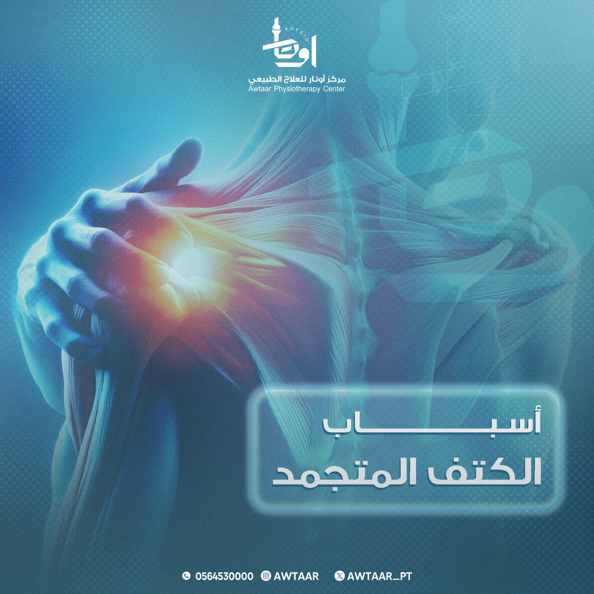 Awtaar_pt's tweet photo. 🛑 يحاط مفصل الكتف بكبسولة من النسيج الضام. وتحدث الإصابة بالكتف المتجمدة عندما يزداد سُمك هذه الكبسولة وتضيقها حول مفصل الكتف، ما يقيد حركته. https://t.co/pCBcmYfBMk