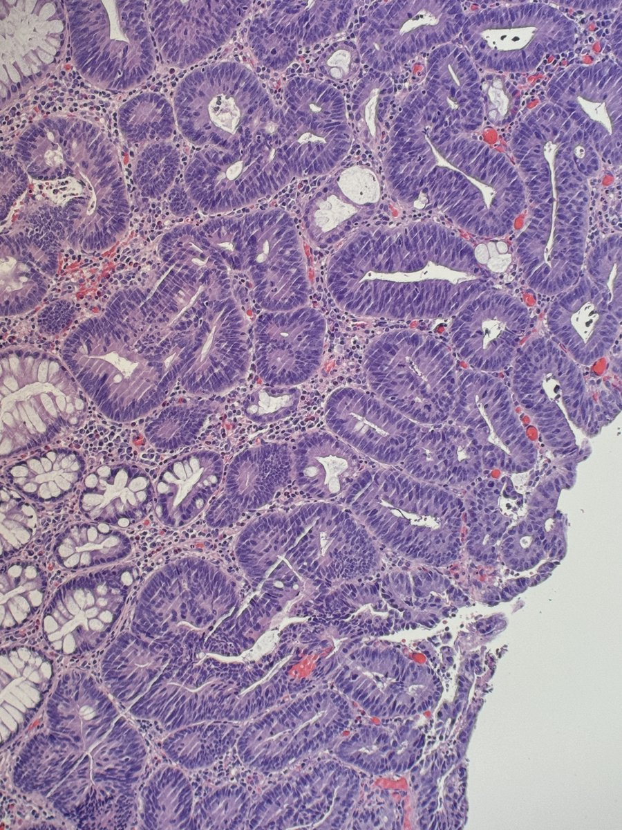 Andres Surgical Path tweet media