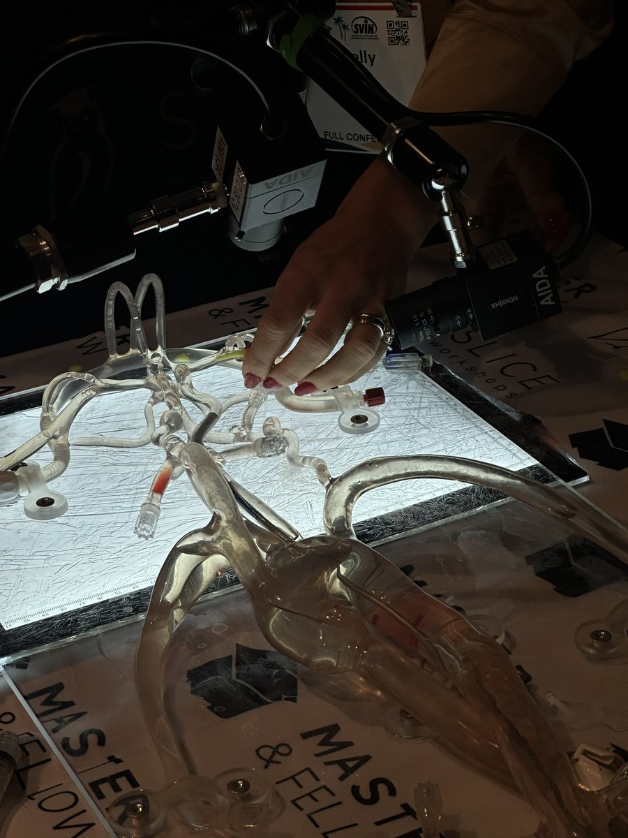 gdawod1's tweet photo. SVIN-SLICE Sessions are here at #SVIN24!

From pediatric stroke cases to bilateral carotid occlusions, @slice_inr interactive cases allow for small group, case discussions combined with use of the flow models, all directed by device reps and experts in the field 

@svinsociety https://t.co/X6fJPc4Wko