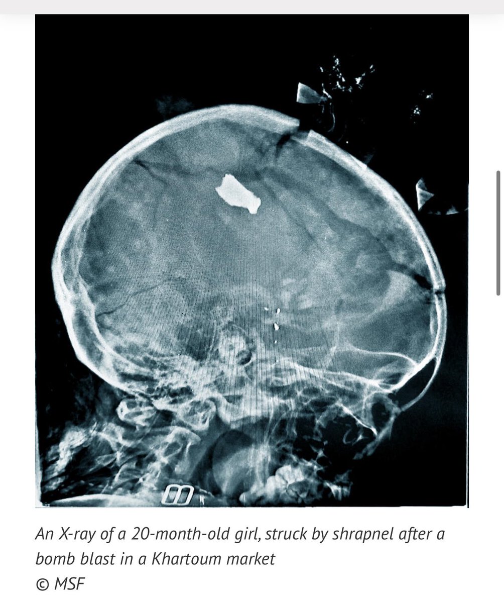 DrJasonBegalke's tweet image. Thinking of all women and children living in conflict zones across the globe.  

#WhenSecondsCount #MedEd #MedX #HealthCare #Sudan #HopeForHealthCare