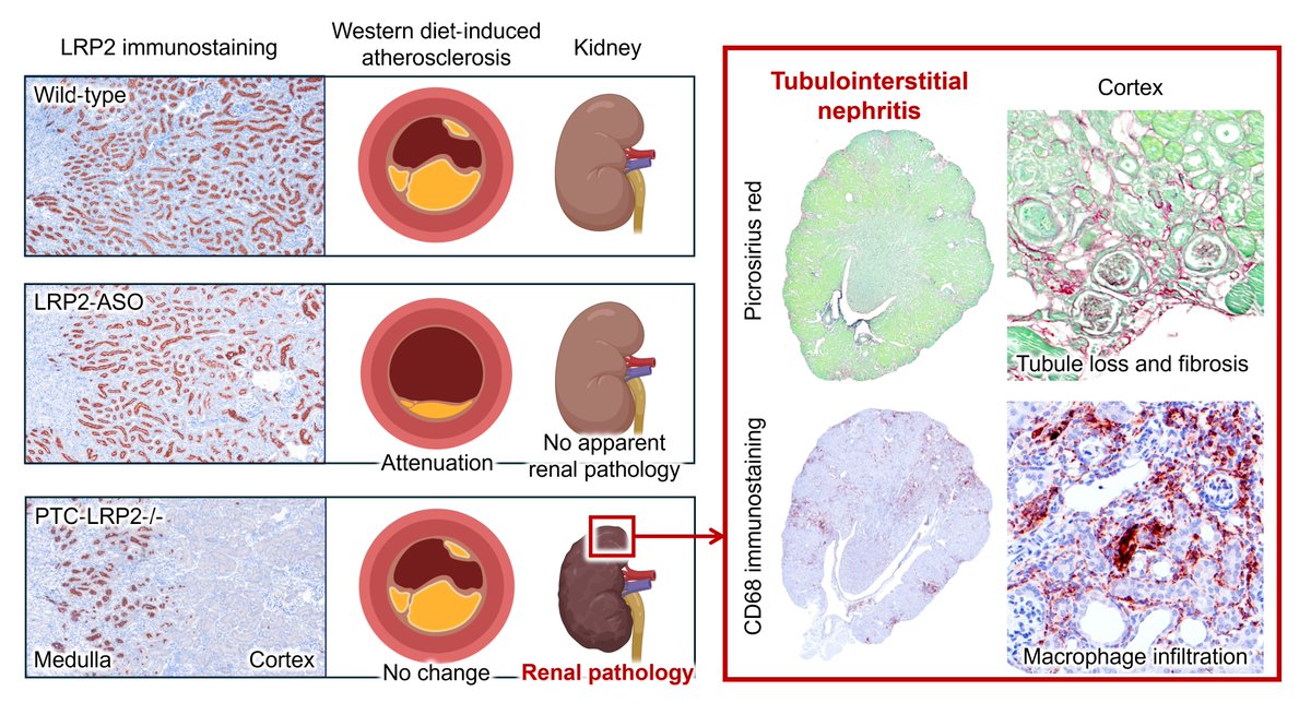 Renal Proximal Tubule Cell-Specific Megalin Deletion Does Not Affect Atherosclerosis But Induces Tubulointerstitial Nephritis in Mice Fed a Western Diet | Arteriosclerosis, Thrombosis, and Vascular Biology ahajournals.org/doi/10.1161/AT…