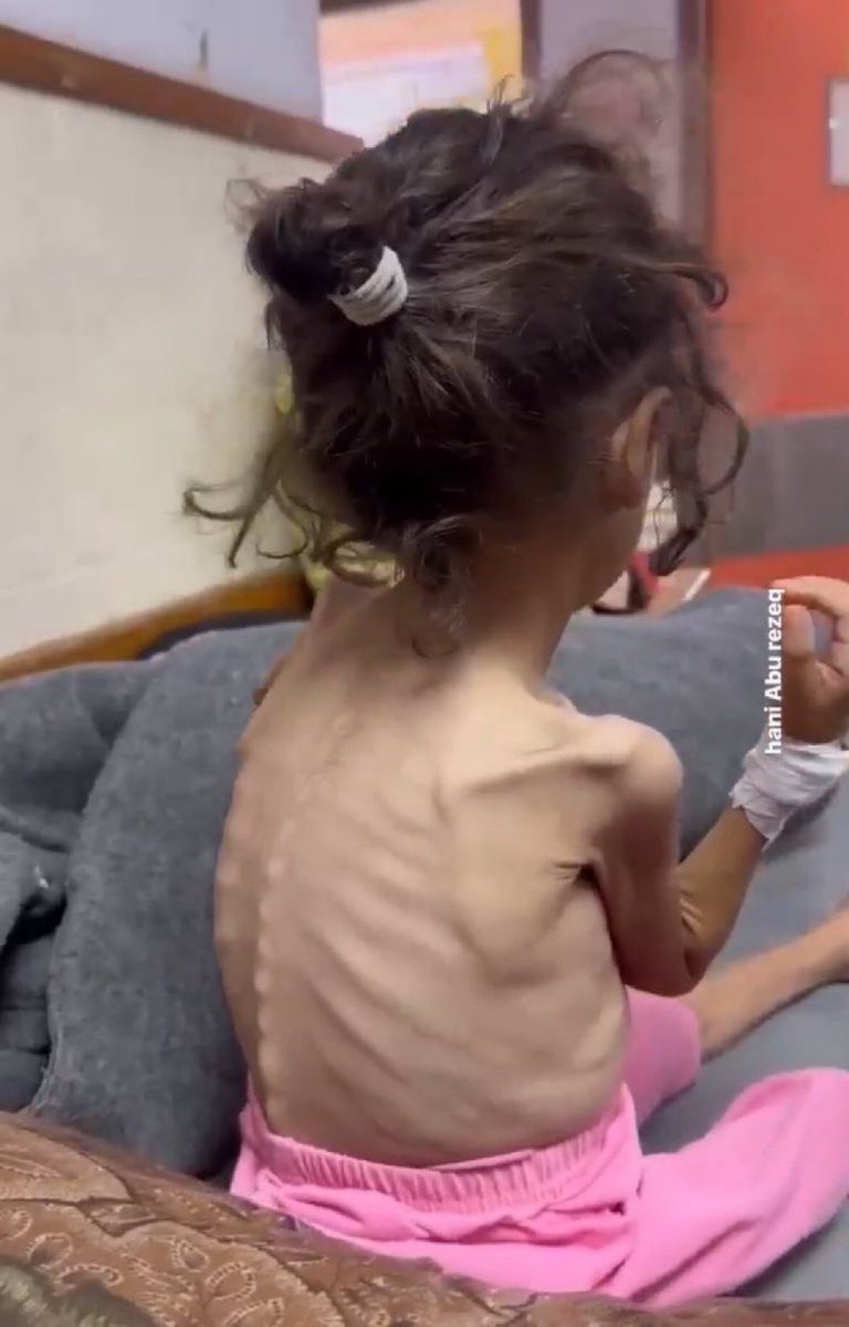 أطفال غزّة 💔