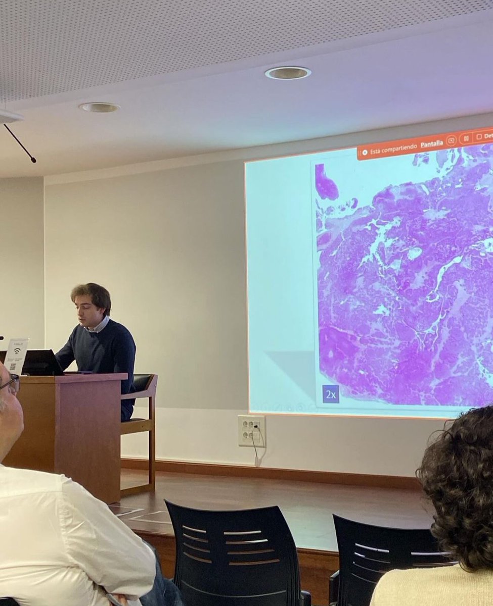 SCAPSoMe's tweet photo. Sessió R2: Dr. Ignasi Espadaler (Hospital Santa Creu i Sant Pau) ens ha presentat un cas interessant de carcinoma nasosinusal multifenotípic relacionat amb el VPH. Excel•lent 🙌. #scap2025 https://t.co/Zfy8Li2epl