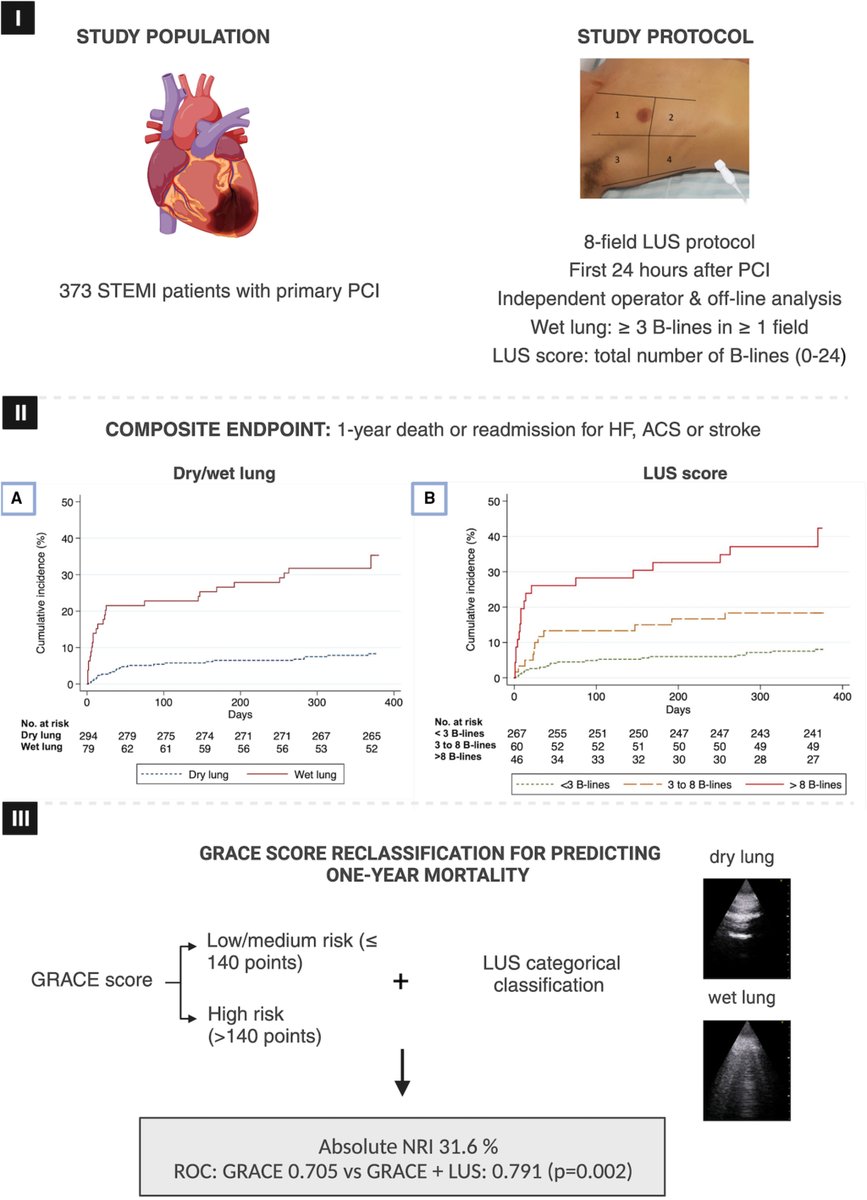 JAHA (@jaha_aha) on Twitter photo In STEMI patients, admission LUS predicted adverse outcomes (death, stroke, HF, ACS) over one year and improved GRACE risk score predictions. #AHAJournals <a href="/jose_carmora/">Jose Carreras Mora</a> <a href="/ASionis/">Alessandro Sionis</a> <a href="/miguelcainzos23/">Miguel Cainzos-Achirica</a> <a href="/beavaquerizo/">Beatriz</a> <a href="/m_rivaslasarte/">Mercedes Rivas-Lasarte</a> <a href="/hospitaldelmar/">Hospital del Mar</a> <a href="/HMar_research/">HMar Research Institute</a> ahajrnls.org/4hZeBb4 In STEMI patients, admission LUS predicted adverse outcomes (death, stroke, HF, ACS) over one year and improved GRACE risk score predictions. #AHAJournals <a href="/jose_carmora/">Jose Carreras Mora</a> <a href="/ASionis/">Alessandro Sionis</a> <a href="/miguelcainzos23/">Miguel Cainzos-Achirica</a> <a href="/beavaquerizo/">Beatriz</a> <a href="/m_rivaslasarte/">Mercedes Rivas-Lasarte</a> <a href="/hospitaldelmar/">Hospital del Mar</a> <a href="/HMar_research/">HMar Research Institute</a> ahajrnls.org/4hZeBb4