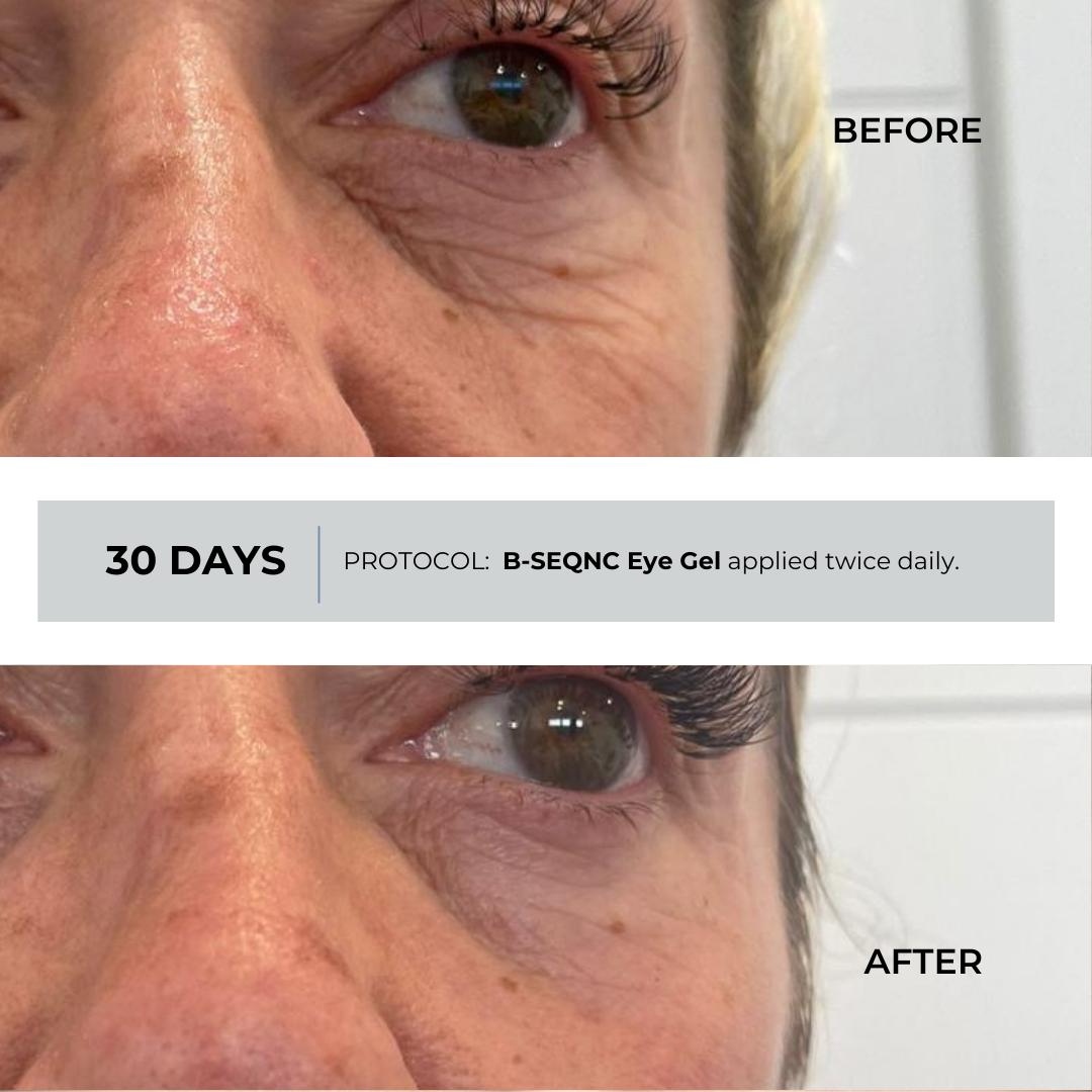 Skinseqnc's tweet photo. 🌟 Real Results in Just 30 Days! 
See the difference with B-SEQNC Eye Gel, a revolutionary skincare solution powered by cutting-edge bioidentical molecules. Clinically proven to reduce fine lines, wrinkles, and dark circles, our eye gel works with your skin’s natural processes... https://t.co/dchH72KbGR