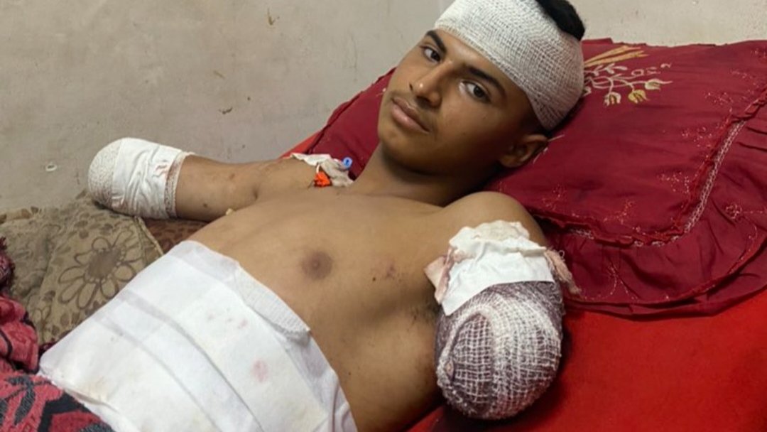 help deyaa get treatments by donating and sharing please!!
@deyaa_Akram14 gofundme.com/f/help-diya-an…