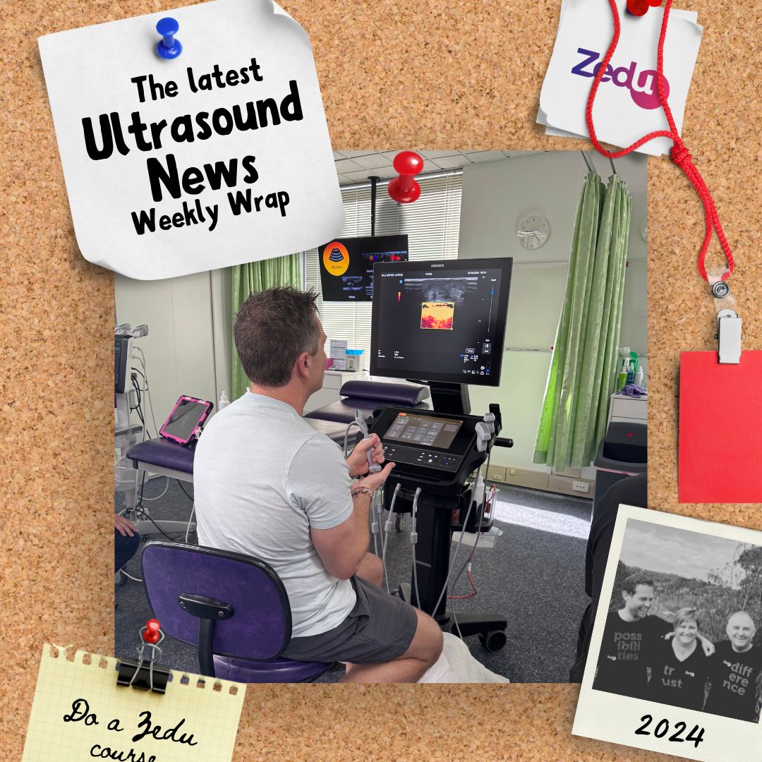 Zedu Ultrasound Training @zedunow@med-mastodon.com (@zedunow) on Twitter photo #Weeklywrap news is out & BlueSkys shining😉
Join us on all platforms & get the latest #POCUS news
#Ultrasound hot of the press from
<a href="/MH_EMultrasound/">MetroHealth Emergency Ultrasound</a>
<a href="/Wilkinsonjonny/">Jonny Wilkinson</a>
<a href="/PratsEM/">Michael I. Prats</a>
<a href="/pocus_today/">pocus.sg</a>
<a href="/ross_prager/">Ross Prager</a>
<a href="/POCUSJournal/">POCUS Journal</a>
👇This & much more
ultrasoundtraining.com.au/news/zedu-week…
#ultrasoundtraining #Weeklywrap news is out & BlueSkys shining😉
Join us on all platforms & get the latest #POCUS news
#Ultrasound hot of the press from
<a href="/MH_EMultrasound/">MetroHealth Emergency Ultrasound</a>
<a href="/Wilkinsonjonny/">Jonny Wilkinson</a>
<a href="/PratsEM/">Michael I. Prats</a>
<a href="/pocus_today/">pocus.sg</a>
<a href="/ross_prager/">Ross Prager</a>
<a href="/POCUSJournal/">POCUS Journal</a>
👇This & much more
ultrasoundtraining.com.au/news/zedu-week…
#ultrasoundtraining