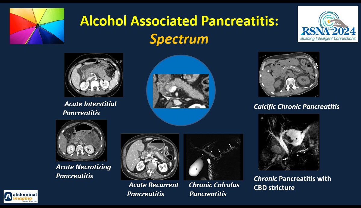 abdo_imaging's tweet photo. Preview of our Educational Exhibit GIEE-113 @ #RSNA2024
We bring insights into the "perils" of #Alcoholism that leads to #pancreatitis. Discuss the Natural History, pathophysiology & Imaging!
We highlight the risk to youth by #binge & #highintensitydrinking.
@mharisinghani https://t.co/edHcHcU1pR