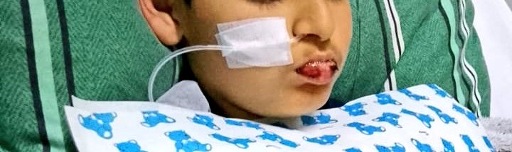 anny_mella's tweet photo. @meganoticiascl Mi sobrino lleva más de 10 días le salieron ampollas en su boca y aún sigue con sondas , así empezó https://t.co/zKOnlU4EEU