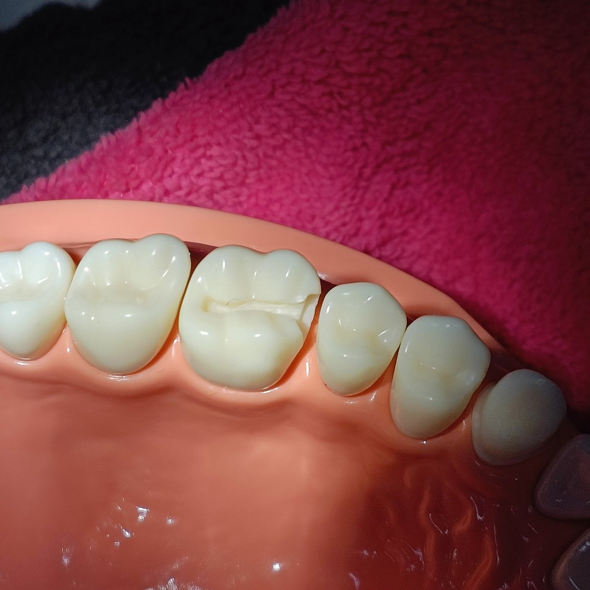 ccassyang's tweet photo. More dent stuff 🦷🧚🏻 https://t.co/nUILLvDMWz