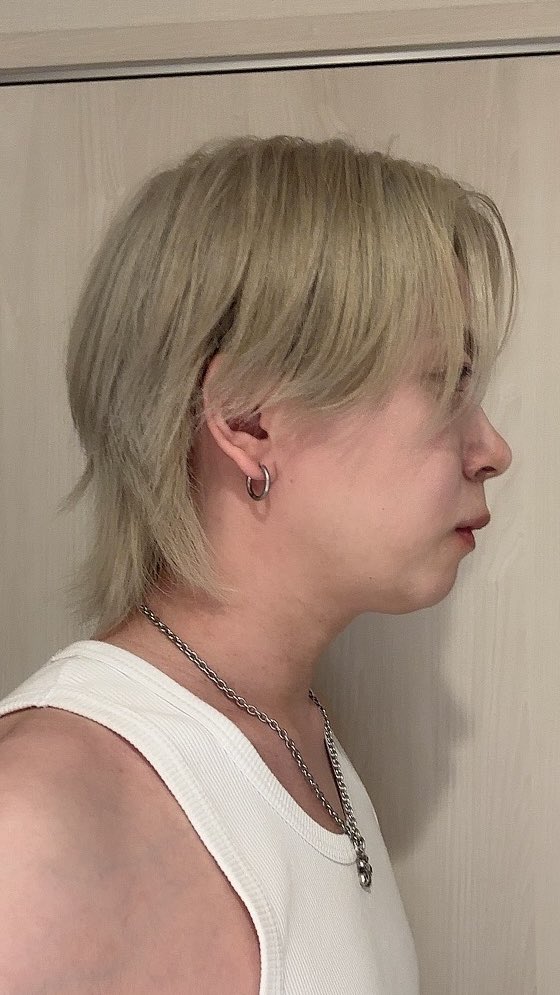 jin_623_'s tweet photo. 〜ダウンタイム3ヶ月経過〜

だいぶ腫れが落ち着いてマスク無しでも出かけられるほどになってきた
腫れは上から引いてくるとの事でまだ小鼻のラインより下は腫れてるけどイケメンになってきたのでは？😎

#id美容外科 #韓国整形 #骨切り
#両顎手術 #Vライン形成
#ルフォー #ssro https://t.co/5ksapX5LA5
