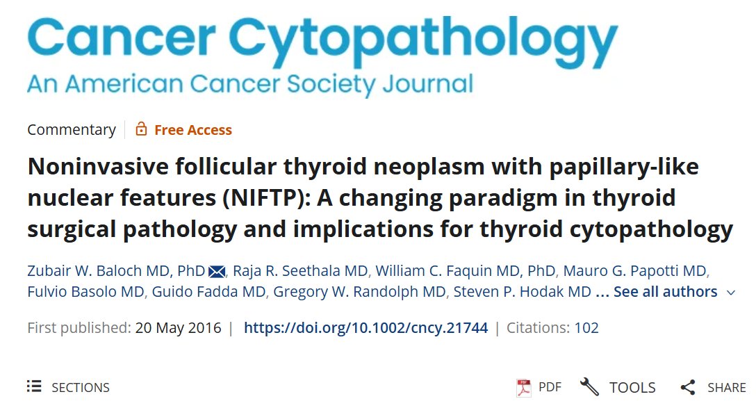 Cancer Cytopathology (@cancercytopath) on Twitter photo Starting 8:00am today at #ASCyto24! Sign-out with our Editorial Board member <a href="/aakasharmand/">Zubair Baloch</a> and discover Diagnostic Clues and Challenges in Everyday Thyroid Cytology.
Revisit his seminal 2016 work on NIFTP here: acsjournals.onlinelibrary.wiley.com/doi/10.1002/cn⌠Starting 8:00am today at #ASCyto24! Sign-out with our Editorial Board member <a href="/aakasharmand/">Zubair Baloch</a> and discover Diagnostic Clues and Challenges in Everyday Thyroid Cytology.
Revisit his seminal 2016 work on NIFTP here: acsjournals.onlinelibrary.wiley.com/doi/10.1002/cnâŚ