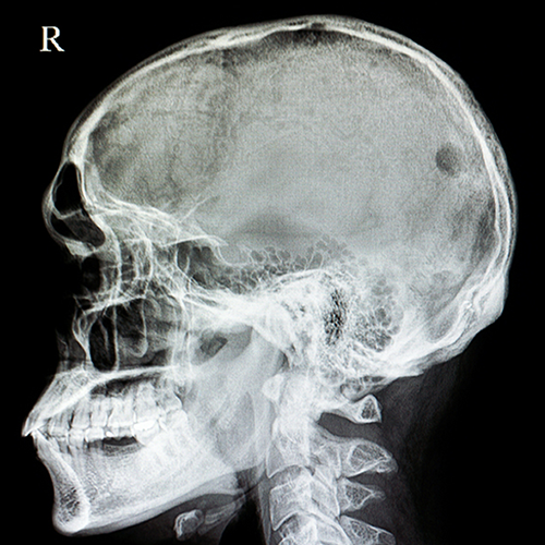 MPS_Medical's tweet image. Casebook Caribbean and Bermuda explores the issue of negligence when interpreting an MRI scan bit.ly/4f7QAMG  

#medicalprotection #negligence