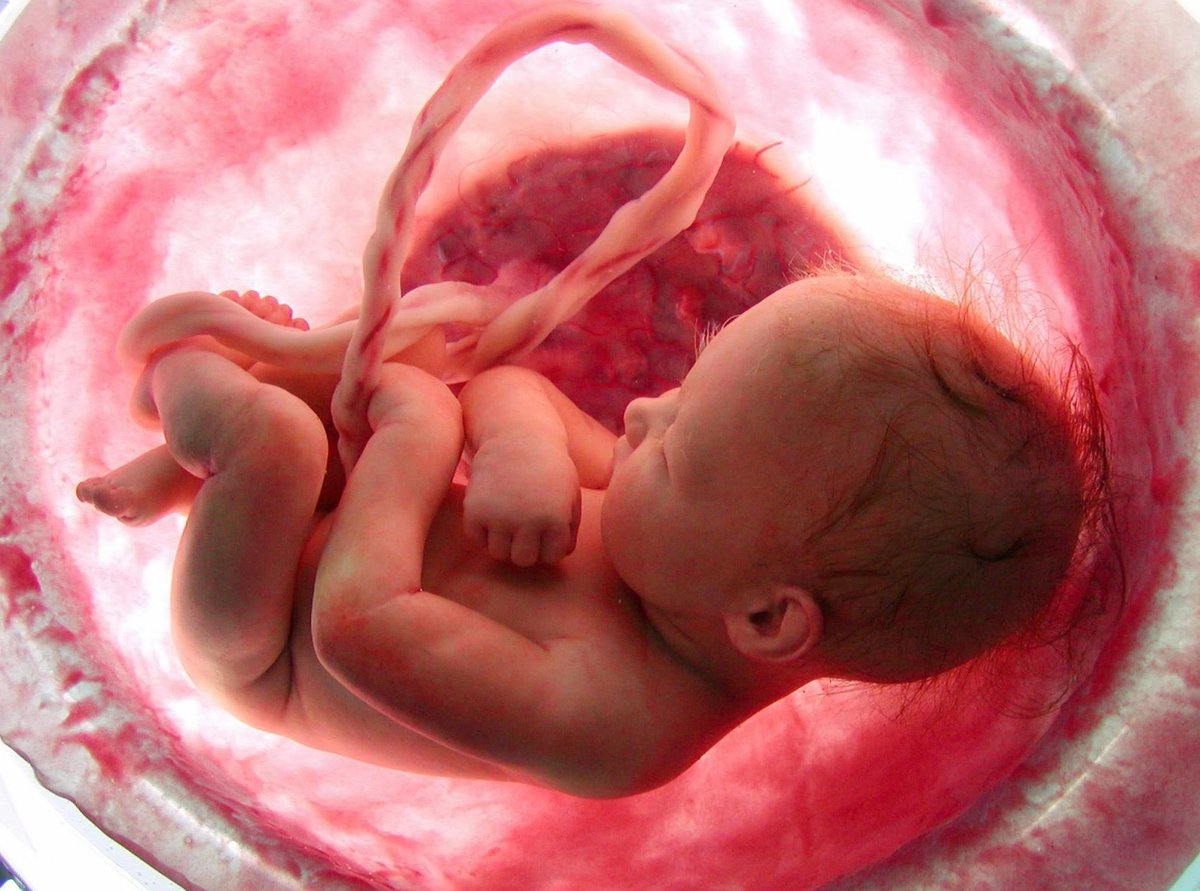AmerangelLorenz's tweet photo. En la próxima elección, recuerda que @PartidoMorenaMx intentó legalizar el homicidio de bebés de hasta 9 meses de gestación, completamente formados y listos para sobrevivir en el mundo exterior.

A los asesinos no se les vota, se les bota. https://t.co/42YaqyaRDe