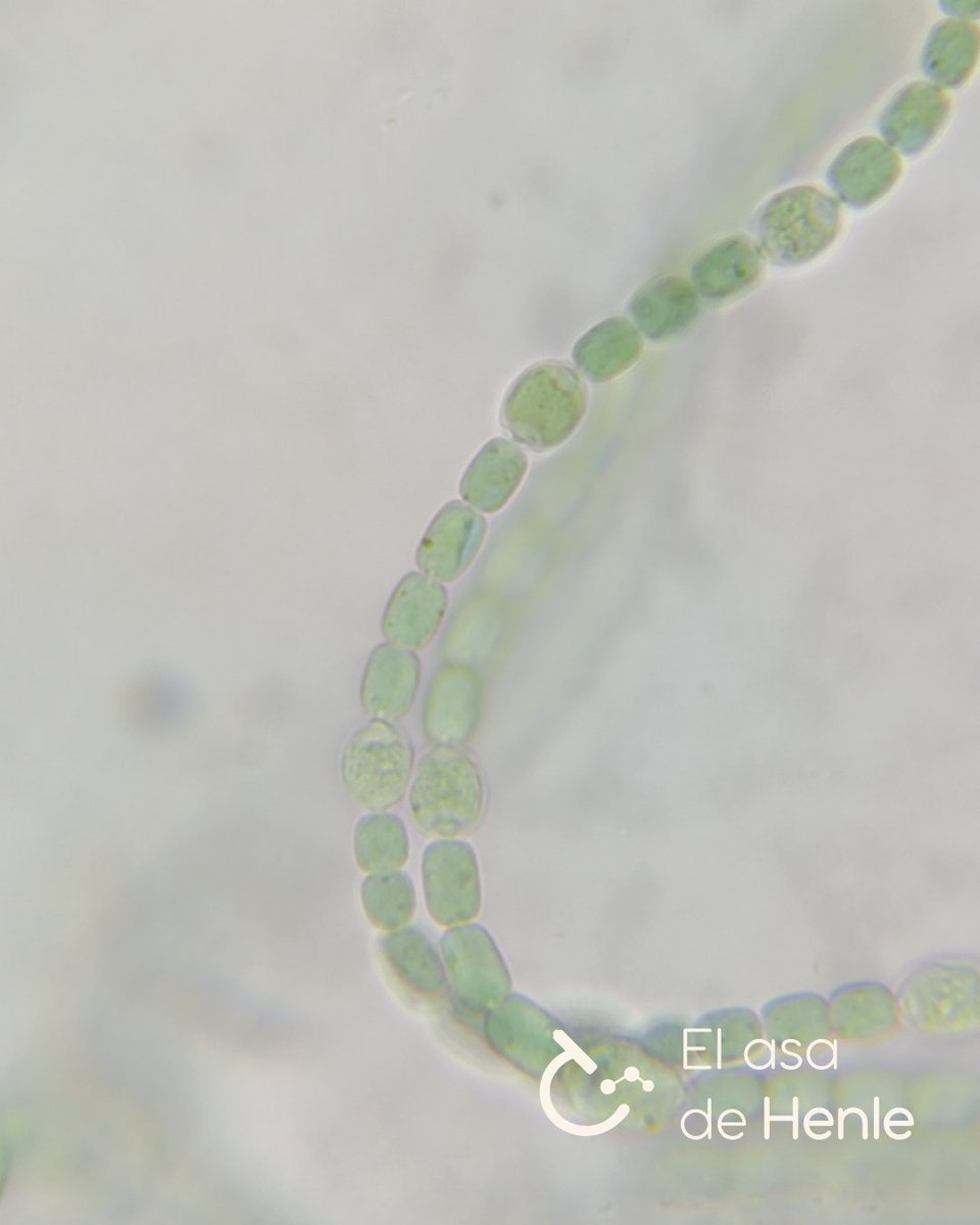 elasadehenle's tweet photo. Azolla sp. - Anabaena azollae. 

Slide 2: Anabaena en cavidad foliar de Azolla. Corte a mano)
Slide 3: Vídeo de Anabaena en cavidad foliar de Azolla. (Corte a mano)
Slide 4: Anabaena. (Aplastado). https://t.co/KAUVbR5FUT
