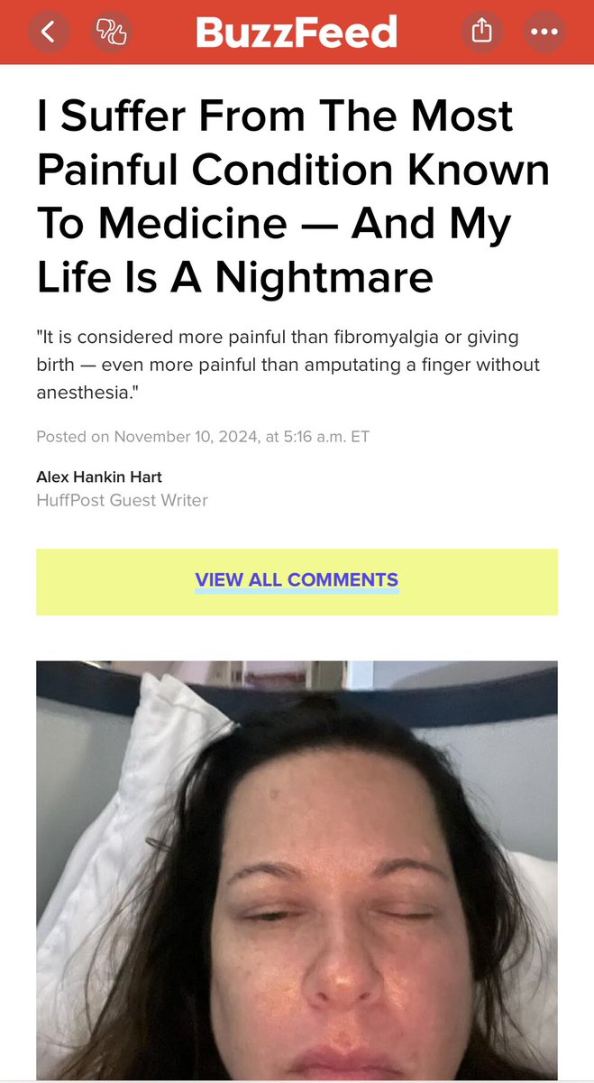 According to the Buzzfeed Journal of social media medicine, CRPS is more painful than amputations without anesthesia, childbirth  and somehow even more painful than fibromyalgia. 😱😱😱 #medtwitter