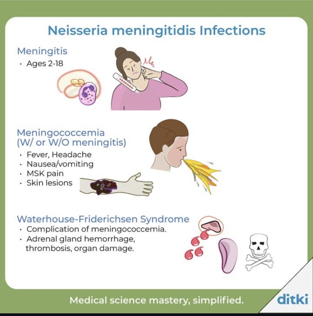 DrMedica_13's tweet photo. Neisseria Meningitis Infections 🦠
•••
#MedEd #MedX #Infections https://t.co/9SFraZVJDi