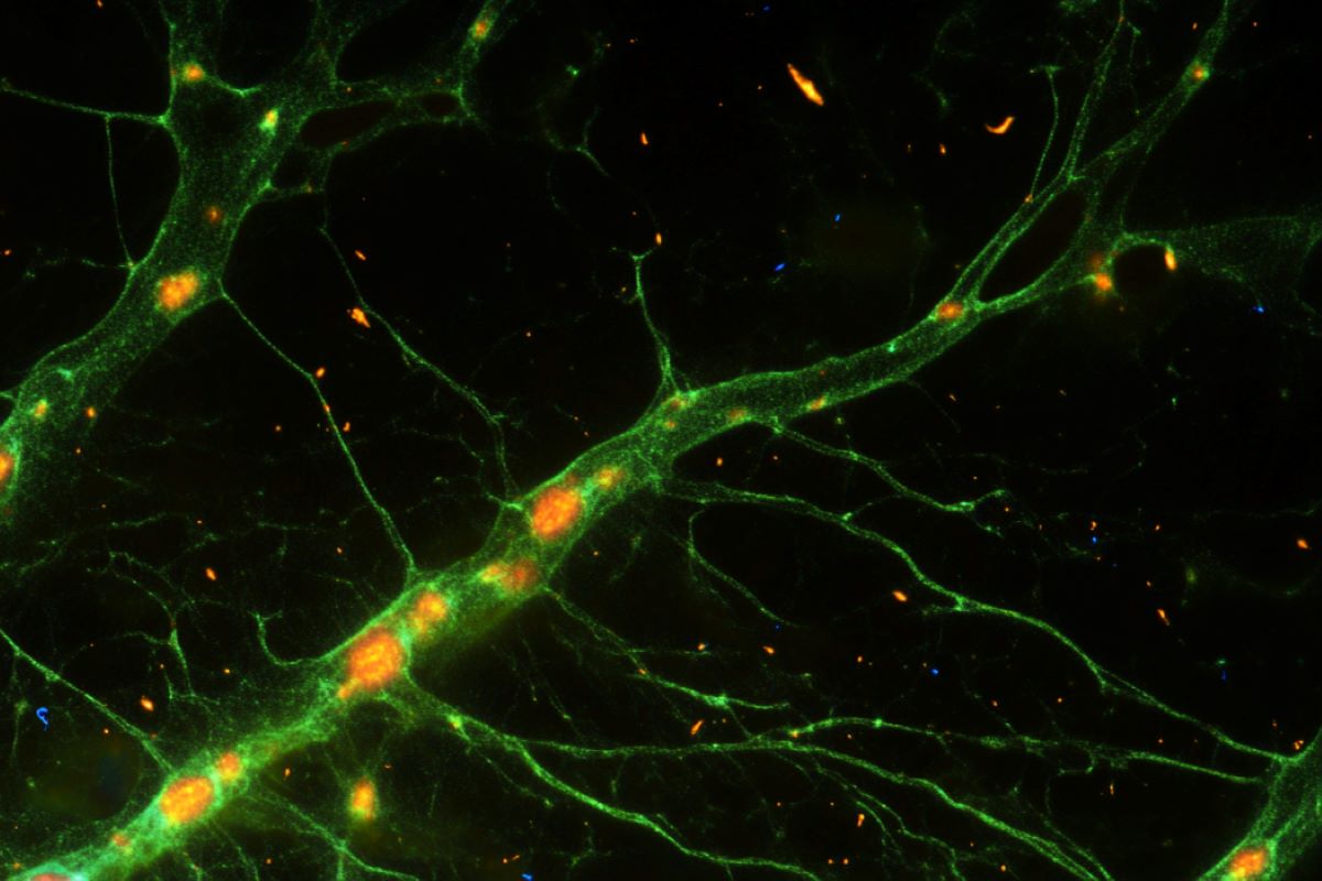 Reprogrammed Brain Cells Could Restore Damaged Circuits

Researchers have successfully reprogrammed brain support cells called astroglia into neuron-like cells that mimic specific interneurons vital for brain functions. 

This study, focusing on regenerative medicine,