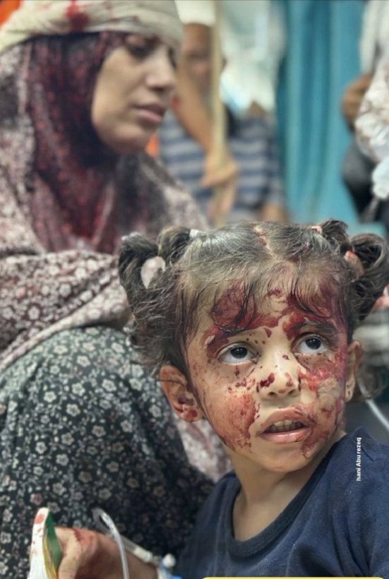 إن أيادينا مغلولةٌ يا غزة ،
لكن قلوبنا والله ثائرةٌ معك ، وهذه أضعف العروبة 
💔..!