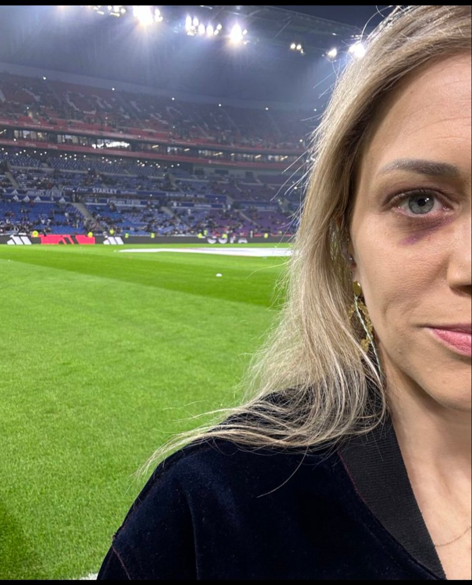 Gael__10's tweet photo. Si elle avait pris ça au Parc des Princes on jouerait à huis clos pendant 6 mois. https://t.co/8NlXuOCI9b